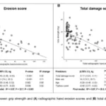 Uric Acid Crystals Damage Hands