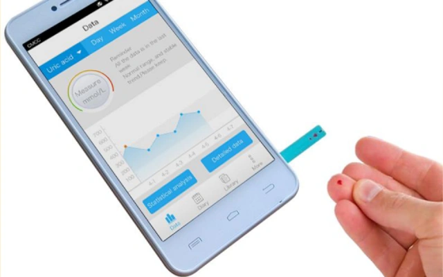 Uric Acid Testing Smartphone